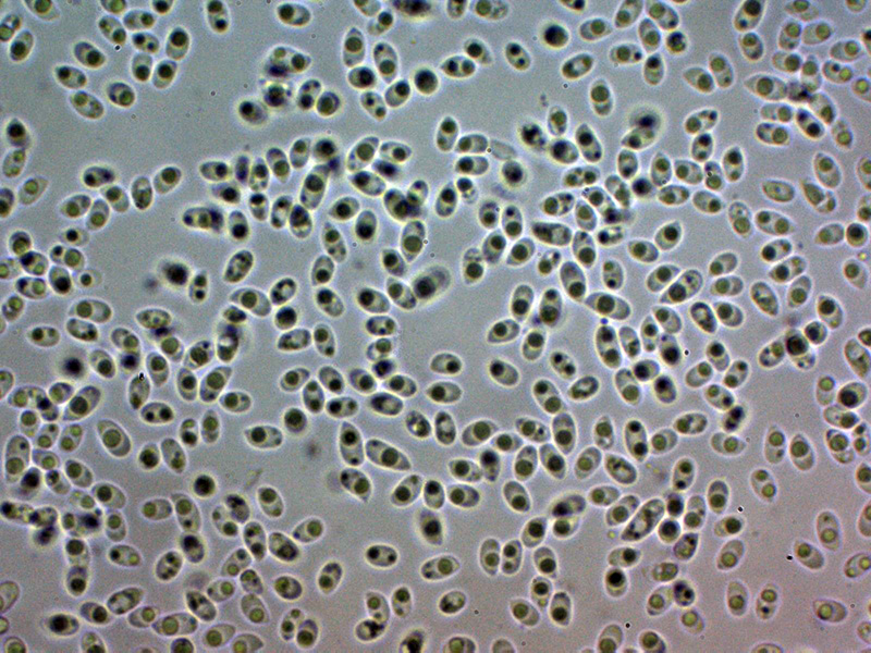 Un hydnoide corticale da identificare